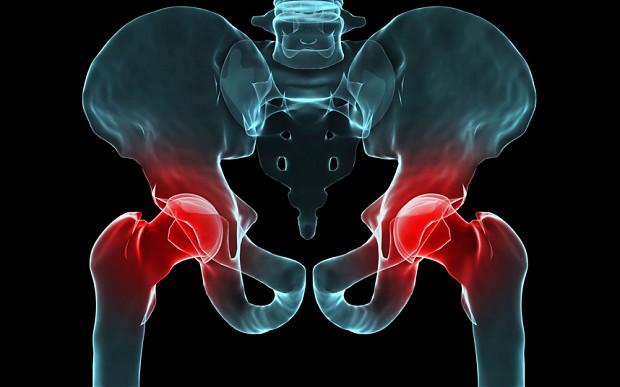 causas del dolor de cadera