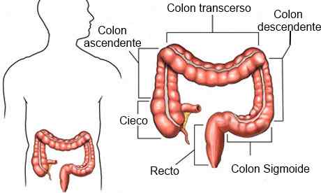 causas del dolor de colon