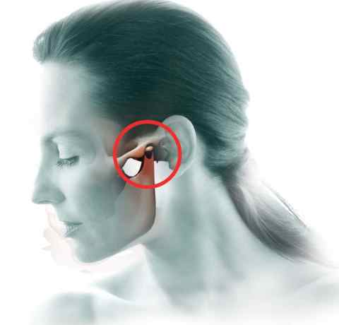 causas del dolor de mandibula